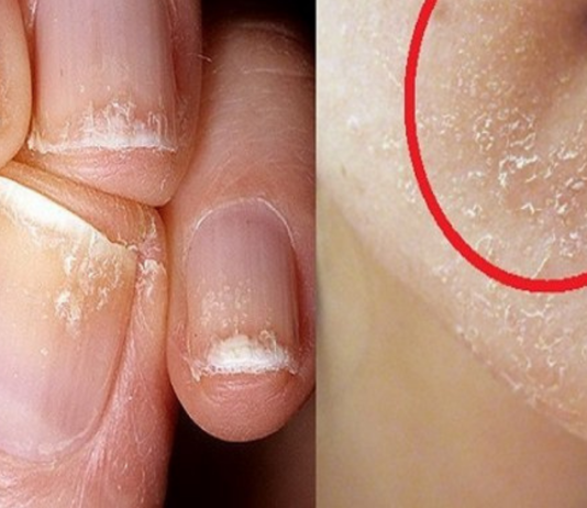 ალბათ ბევრს გასჩენია შეკითხვა რა სიმპტომების მატარებელია D ვიტამინის დეფიციტი ორგანიზმში, ამ სტატიაში კი სწორედაც, რომ ყველა მათგანს დეტალურად განვიხილავთ. .