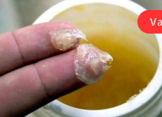 ტკივილგამაყუჩებელი მალამო, რომელიც დარწმუნებულნი ვართ ბევრს გამოადგება! თან მზადდება სახლის პირობებში