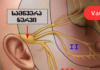 თუ გაწუხებთ სამწვერა ნერვის ანთება, ეს რეცეპტი აუცილებლად გამოგადგებათ, ამისთვის კი უმარტივესი რეცეპტის გამოყენება მოგიწევთ!