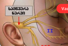 თუ გაწუხებთ სამწვერა ნერვის ანთება, ეს რეცეპტი აუცილებლად გამოგადგებათ, ამისთვის კი უმარტივესი რეცეპტის გამოყენება მოგიწევთ!