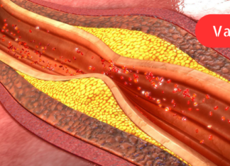 70-ს უკვე გადავცილდი, მაგრამ სულაც არ ვაპირებ დავმორჩილდე ბედს! წამლები არ მიყვარს, მაგრამ ძალიან ვაფასებ ხალხურ რეცეპტებს და სწორედ დედაჩემის ჩანაწერებში ვიპოვე ათეროსკლეროზის სამკურნალო რეცეპტი: