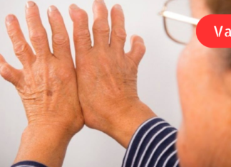 სახსრების ქრონიკული დაავადებებისა და რევმატიზმის მკურნალობის ჩემეული მეთოდი ასეთია! სახსრების ანთება და ტკივილი თანდათანობით იკლებს. .