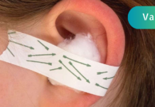 “როგორ მოვიშოროთ ყურის ტკივილი სულ რაღაც 1 წუთში?! წვეთები, რომლებსაც მე ყოველთვის წარმატებულად ვიყენებ” . .