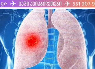 ხალხური მეთოდი ფილტვებიდან სითხის გამოსადევნად! მეტად საჭირო და საყურადღებო საკითხია