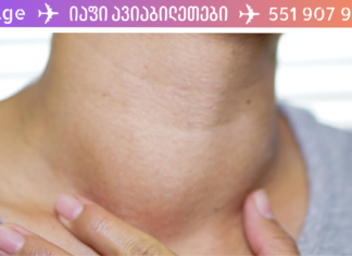 “ჩემს 16 წლის შვილს ყბის ქვეშ გადიდებული ჰქონდა ლიმფური კვანძები. ხალხურ მედიცინას მივმართე საშველად და სწორადაც მოვიქეცი, რადგან ბავშვს ლიმფური კვანძები გაუქრა და ახლა მინდა ჩემი გამოცდილება თქვენც გაგიზიაროთ”