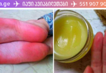 თუ ფეხის გულები თქვენც გიხურთ, მარტო ნამდვილად არხართ! ჩვენ გასწავლით რეცეპტს, რომელიც ამ დროს ეფექტურად გამოგადგებათ. .