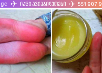 თუ ფეხის გულები თქვენც გიხურთ, მარტო ნამდვილად არხართ! ჩვენ გასწავლით რეცეპტს, რომელიც ამ დროს ეფექტურად გამოგადგებათ. .