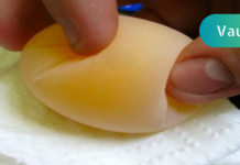 სახსრების და ძვლების ტკივილის ნამდვილი მაშველი აღმოვაჩინე! საკმარისია ჭამამდე მიირთვათ 1ს.კ ნარევი