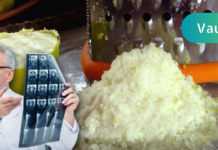 თუ ლიმონს გაყინავთ დიაბეტს და სიმსუქნეს დაივიწყებთ! ამ საიდუმლო იარაღის გამოცდა ნამდვილად ღირს