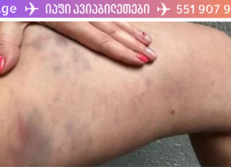 ეს სასწრაფოა!! კანის 3 ცვლილება, რომელიც ღვიძლის ციროზზე მიგანიშნებთ