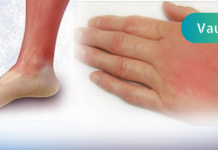 წითელი ქარი – ჯანმრთელობის პრობლემა, რომელიც ამ მცენარეული რეცეპტებით როგორც იქნა დავამარცხე!! ჩემსაცით მადლიერები დარჩებით, სცადეთ. .