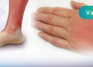 წითელი ქარი – ჯანმრთელობის პრობლემა, რომელიც ამ მცენარეული რეცეპტებით როგორც იქნა დავამარცხე!! ჩემსაცით მადლიერები დარჩებით, სცადეთ. .