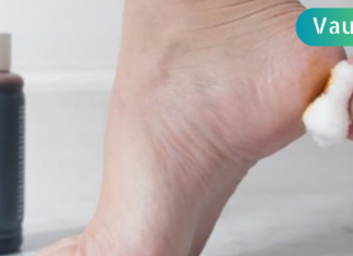 იოდი ფეხებისთვის, როგორც ბევრი დაავადების სამკურნალო უდაოდ საუკეთესო საშუალება!!