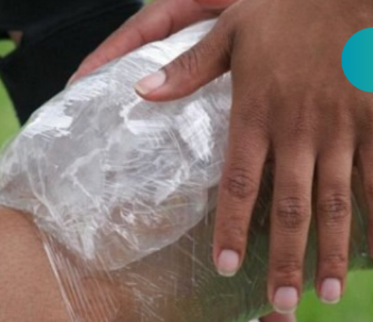 ნაღრძობი ერთ-ერთი ყველაზე გავრცელებული დაზიანებაა. ისწავლეთ ექსტრემალური დახმარების გაწევა ყველა წესის დაცვით!