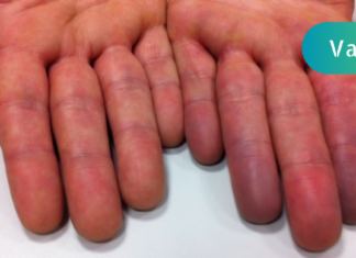 სულ რაღაც 30 წამში შეამოწმეთ, რამდენად კარგად მუშაობს თქვენი გული მხოლოდ ხელებისა და ცივი წყლის გამოყენებით!!