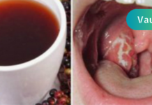 როგორ მოვიშოროთ ყელის ინფექცია სულ რაღაც 4 საათში! ცდად ღირს