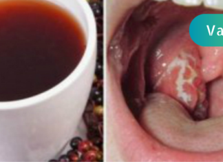 როგორ მოვიშოროთ ყელის ინფექცია სულ რაღაც 4 საათში! ცდად ღირს