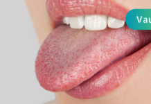 მაშ ასე, გავარკვიოთ რისი თქმა შეუძლია ენის ცვლილებას ჩვენს ჯანმრთელობაზე?