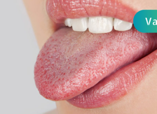 მაშ ასე, გავარკვიოთ რისი თქმა შეუძლია ენის ცვლილებას ჩვენს ჯანმრთელობაზე?