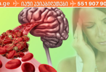 თრომბები – ჩუმი საფრთხე ჩვენი სიცოცხლისთვის.გაიგეთ როგორ ვებრძოლოთ პრობლემას და რა იწვევს მას!