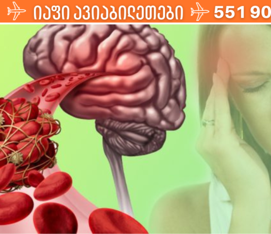 თრომბები – ჩუმი საფრთხე ჩვენი სიცოცხლისთვის.გაიგეთ როგორ ვებრძოლოთ პრობლემას და რა იწვევს მას!